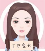 墊下巴多久可以側(cè)睡？恢復(fù)期是多久？