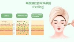果酸換膚后怎么保養(yǎng)避免復(fù)發(fā)