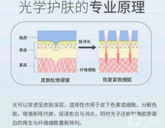光子嫩膚性怎么樣？
