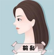 什么人群適合墊鼻梁？墊鼻梁的相關(guān)知識(shí)有哪些