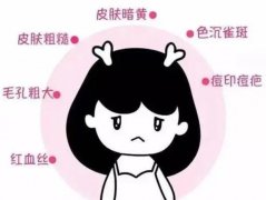 什么是果酸換膚？有哪些優(yōu)勢和劣勢？