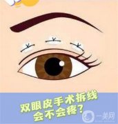 雙眼皮什么時候做好？雙眼皮適合秋天做嗎?