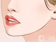 下頜角切除的歷史以及留角與否的講解？