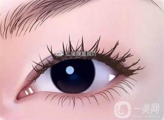 不適合開眼角的人群？不適合開眼角的人群有哪些？