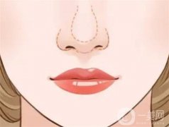 手術需要多少錢？注意事項有哪些？