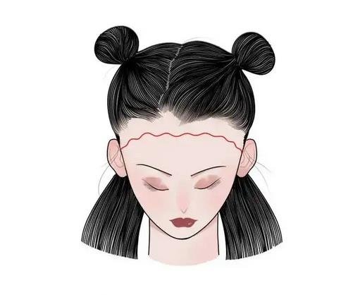 西南醫(yī)院美容整形科*新價(jià)格表公布,附植發(fā)案例*果