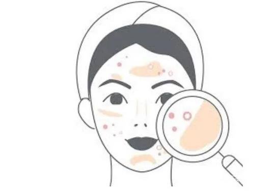 青醫(yī)附院整形科*新價格表公布,附點痣真人案例術(shù)后*果