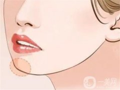 墊下巴多久才能完全恢復(fù)？怎么保養(yǎng)