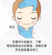 抽脂減肥后的疼痛怎么緩解？面部可以抽脂嗎？