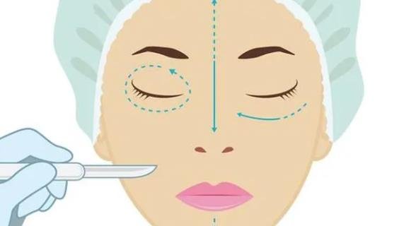 成都雙眼皮價格