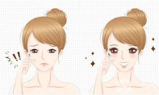 全切雙眼皮的眼部整形手術(shù)*果是*嗎