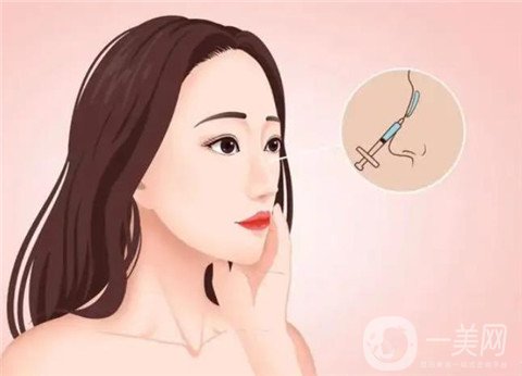 *一個月定型了嗎?能完全消腫嗎?