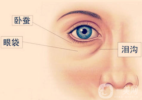 玻尿酸豐臥蠶會(huì)擴(kuò)散嗎 注意事項(xiàng)有哪些