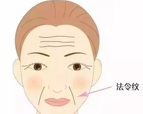 法令紋怎么去除呢？