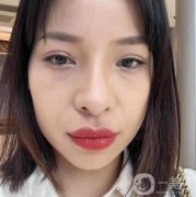 眼袋的形成讓我脾氣變得暴躁起來，父母說我是因?yàn)橥ㄏ蛘呤菒劭薏虐l(fā)生的