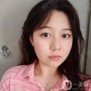 大家都說(shuō)臉上有疤的人，小時(shí)候一定會(huì)皮，我爸媽都管不住我