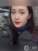 大家都讓我出一期熱瑪吉的視頻，但是我還沒(méi)有做過(guò)熱瑪吉的手術(shù)