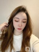 注射完了玻尿酸以后，我的臉有一些腫脹感，但不是很嚴重，當時我的臉上還貼