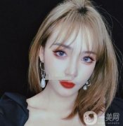 做熱瑪吉之前，我臉上有很多痘印，鼻翼兩邊的毛孔也特別的粗大