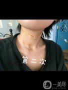 脖子真的就是女人的第二張臉，所以大家在保養(yǎng)自己臉蛋的同時(shí)，也不要忘記自