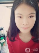 我覺得現(xiàn)在的眼睛還不如手術(shù)之前的單眼皮好看呢，正等我為自己更加難看的眼