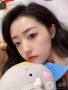 醫(yī)生也是建議本人做個(gè)拉皮的項(xiàng)目，看了許多案例，感覺(jué)做出來(lái)效果相當(dāng)不錯(cuò)