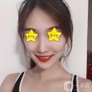 今天終于要完成我多年的夢(mèng)想，去醫(yī)院做改臉型手術(shù)，心情好激動(dòng)呀