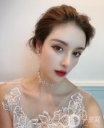 才發(fā)現(xiàn)我的毛囊已經(jīng)完全壞死，也只能通過植發(fā)來進行解決了