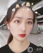 眼綜合手術(shù)已經(jīng)過(guò)去四個(gè)月的時(shí)間了，自從我做完手術(shù)之后，我?guī)ьI(lǐng)了我身邊的