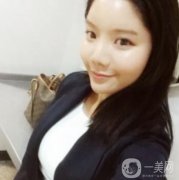 做完面部填充手術(shù)已經(jīng)過去一周的時間了，其實自己照鏡子就能發(fā)現(xiàn)這段時間恢