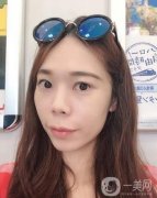 做完熱瑪吉項目已經(jīng)兩個月的時間了，近我還給醫(yī)生發(fā)去了我現(xiàn)在的照片