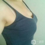 在隆胸拆線之后幾乎我就恢復(fù)了正常的生活了，也可以正常的洗澡了，就是需要