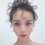 做完隆鼻手術(shù)已經(jīng)有一個月的時間了，身邊的朋友看到我都說我的鼻子變好看了