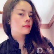 電波拉皮去頸紋第三天，并沒有感覺到不舒服，我現(xiàn)在只要一有時間就照鏡子