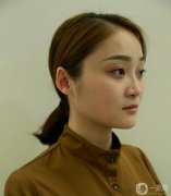 手術(shù)后恢復(fù)了半個(gè)月，鼻子不太腫,恢復(fù)的比較自然