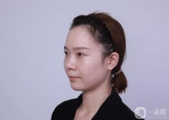 我的鼻子一點都不立體,早就想弄鼻子了