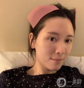 做完熱瑪吉，臉部的整體輪廓特別的明顯