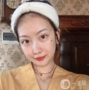 做完熱瑪吉之后，皮膚變得的緊致，滿臉的膠原蛋白