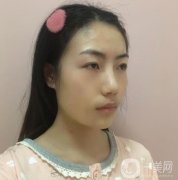 熱瑪吉這個(gè)項(xiàng)目真的是特別的神奇，皮膚是越來(lái)越穩(wěn)固