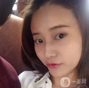 熱瑪吉真的是現(xiàn)在流行的抗衰項(xiàng)目了