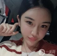 熱瑪吉真的能夠很大程度的改良面部松弛下垂的