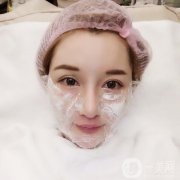 做完熱瑪吉之后，明顯的可以看出我的臉皮膚變緊致了