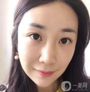 熱瑪吉在抗衰方面還是有不錯的結(jié)果