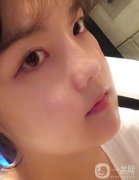 面部拉皮手術(shù)的效果好