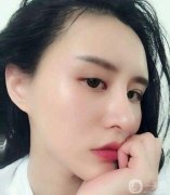 面部填充后，臉摸起來(lái)很軟可以隨意按捏