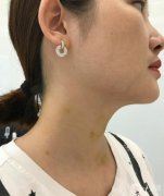 有一天突然發(fā)現(xiàn)所有的頸紋都是頸紋，很多護膚品都沒有效果