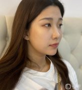 我也想了很久，決定過(guò)來(lái)做一個(gè)黃金微雕吸脂來(lái)解決我的問(wèn)題