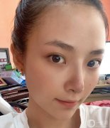 雖然從小到大的朋友都說我長得好看，但我總是對自己的鼻子不滿意