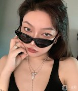 手術(shù)前，我的鼻子很大，山根塌了，側(cè)面看起來像狗鼻子