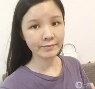 臉部的腫脹正在慢慢減輕，淤青也在消失，越來越正常